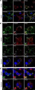 EEA1 Antibody in Immunocytochemistry (ICC/IF)