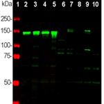 NEFM Antibody in Western Blot (WB)