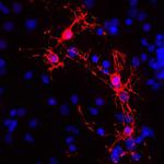 MBP Polyclonal Antibody