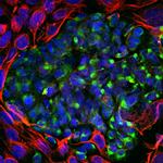 Peripherin Polyclonal Antibody