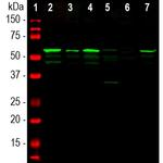 Peripherin Antibody in Western Blot (WB)
