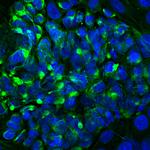 Peripherin Antibody in Immunocytochemistry (ICC/IF)