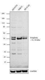 Peripherin Antibody in Western Blot (WB)