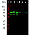 Peripherin Antibody in Western Blot (WB)