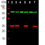 PGP9.5 Antibody in Western Blot (WB)