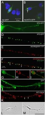 Chromogranin C Antibody in Immunocytochemistry (ICC/IF)