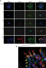 Chromogranin C Antibody in Immunocytochemistry (ICC/IF)