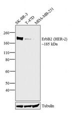 ErbB2 (HER-2) Polyclonal Antibody