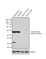 Calcineurin A Polyclonal Antibody