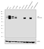 beta Amyloid Antibody in Western Blot (WB)