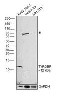 TYROBP Polyclonal Antibody