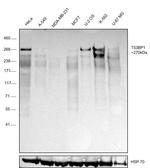 53BP1 Antibody in Western Blot (WB)