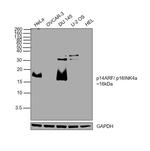 p14ARF Antibody in Western Blot (WB)