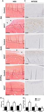 Aggrecan Neo Antibody in Immunohistochemistry (Paraffin) (IHC (P))