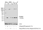PSMB9 Polyclonal Antibody