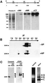 PSME4 Antibody in Western Blot (WB)