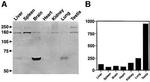 PSME4 Antibody in Western Blot (WB)