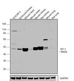 WT1 Antibody