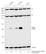 TIMP2 Polyclonal Antibody