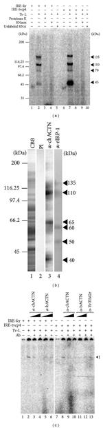 alpha Actinin 1 Antibody in Gel Shift (GS)