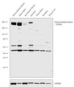 Myosin Skeletal Muscle Antibody in Western Blot (WB)