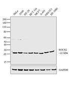 SOCS2 Antibody in Western Blot (WB)