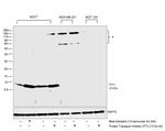 TFF1 Antibody in Western Blot (WB)