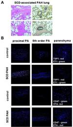 Thrombospondin 1 Polyclonal Antibody