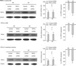 TRPV1 Antibody in Western Blot (WB)