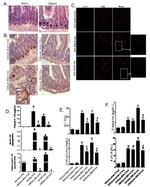 Lysozyme Antibody in Immunohistochemistry (IHC)