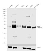BNIP3L Antibody in Western Blot (WB)