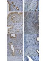 Estrogen Receptor beta Antibody in Immunohistochemistry (IHC)