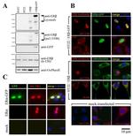 Estrogen Receptor beta Antibody in Western Blot, Immunocytochemistry (WB, ICC/IF)