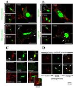 Estrogen Receptor beta Antibody in Immunohistochemistry (IHC)