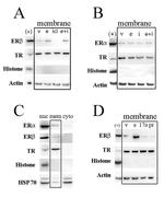 Estrogen Receptor beta Antibody in Western Blot (WB)