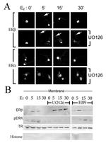 Estrogen Receptor beta Antibody in Western Blot (WB)