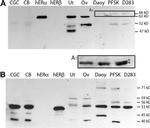 Estrogen Receptor beta Antibody in Western Blot (WB)