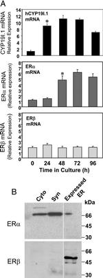 Estrogen Receptor beta Antibody in Western Blot (WB)