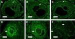 Estrogen Receptor beta Antibody in Immunohistochemistry (IHC)