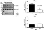 Estrogen Receptor beta Antibody in Western Blot (WB)