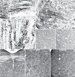 Estrogen Receptor beta Antibody in Immunocytochemistry (ICC/IF)