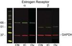Estrogen Receptor beta Antibody in Western Blot (WB)