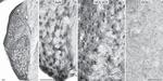 Estrogen Receptor beta Antibody in Immunocytochemistry (ICC/IF)