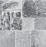 Estrogen Receptor beta Antibody in Immunocytochemistry (ICC/IF)