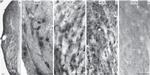 Estrogen Receptor beta Antibody in Immunohistochemistry, Immunocytochemistry (IHC, ICC/IF)