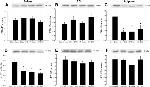 Estrogen Receptor beta Antibody in Western Blot (WB)