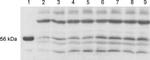 Estrogen Receptor beta Antibody in Western Blot (WB)