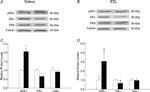 Estrogen Receptor beta Antibody in Western Blot (WB)