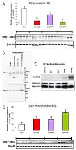 Estrogen Receptor beta Antibody in Western Blot (WB)