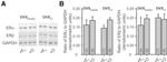 Estrogen Receptor beta Antibody in Western Blot (WB)